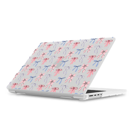Coquette Girlie | Pastel Bows Laptop Shell